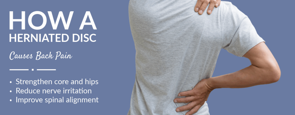 How a Herniated Disc Causes Back Pain